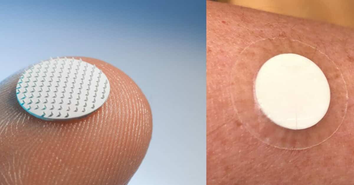 MyLife Technologies, a Dutch medtech startup developing ceramic vaccine patches, secures €3.5M
