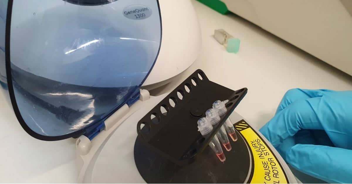 Rapid coronavirus test: Oxford scientists develop new Covid-19 testing kit that can return results in 30 minutes