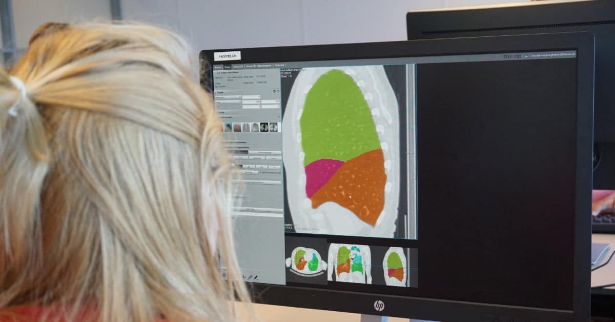 These Dutch startups join hands for ‘Radiology of the Future’ project, bag €1.5M funding from ERDF